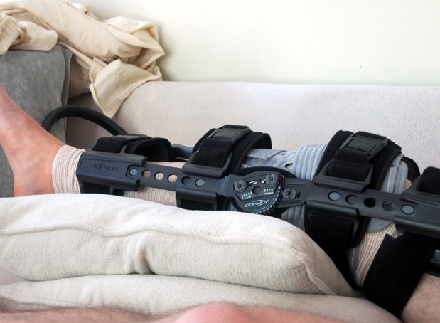 acl surgery brace