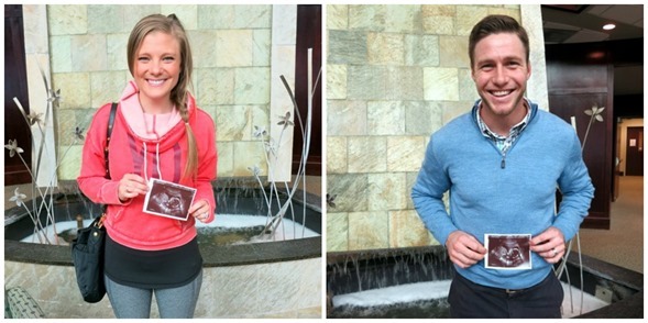 18 weeks anatomy scan ultrasound