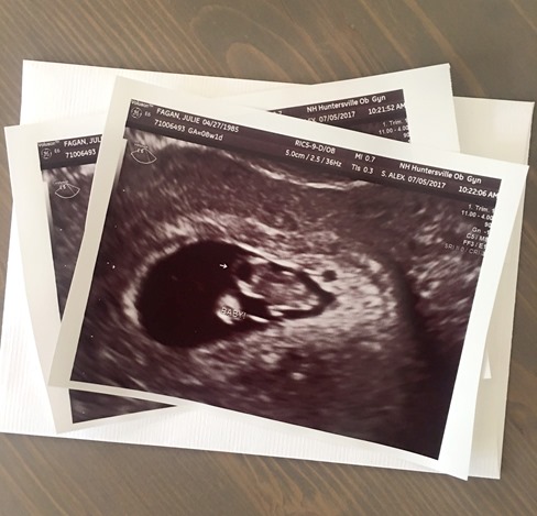 8 Week Ultrasound